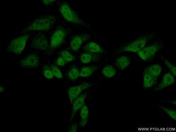 SUPT5H Rabbit anti-Human, Mouse, Rat, Polyclonal, Proteintech 150 &mu;L;