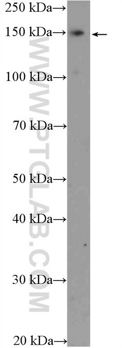 SUPT5H Rabbit anti-Human, Mouse, Rat, Polyclonal, Proteintech 150 &mu;L;