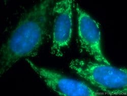 CXXC5 Rabbit anti-Human, Mouse, Rat, Polyclonal, Proteintech 150 &mu;L;