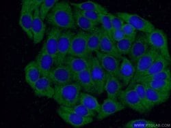 CXXC5 Rabbit anti-Human, Mouse, Rat, Polyclonal, Proteintech 150 &mu;L;