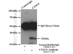 CXXC5 Rabbit anti-Human, Mouse, Rat, Polyclonal, Proteintech 150 &mu;L;