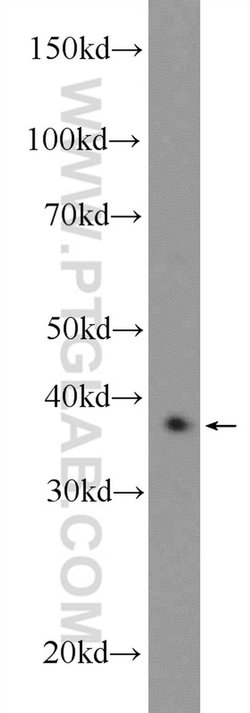 CXXC5 Rabbit anti-Human, Mouse, Rat, Polyclonal, Proteintech 150 &mu;L;