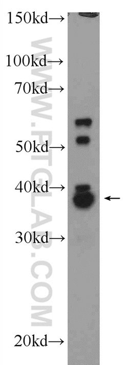 CXXC5 Rabbit anti-Human, Mouse, Rat, Polyclonal, Proteintech 150 &mu;L;