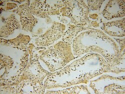 MRPL19 Rabbit anti-Human, Mouse, Rat, Polyclonal, Proteintech 150 &mu;L;