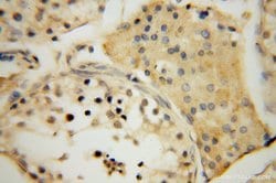 MRPL19 Rabbit anti-Human, Mouse, Rat, Polyclonal, Proteintech 150 &mu;L;