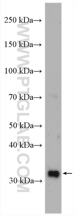 MRPL19 Rabbit anti-Human, Mouse, Rat, Polyclonal, Proteintech 150 &mu;L;