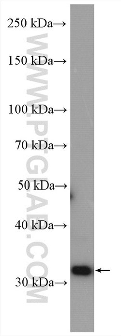 MRPL19 Rabbit anti-Human, Mouse, Rat, Polyclonal, Proteintech 150 &mu;L;