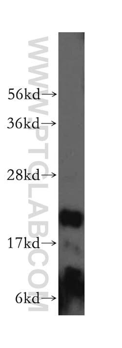 RNASEH2C Rabbit anti-Human, Polyclonal, Proteintech 150 &mu;L; Unconjugated:Antibodies,