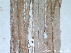 Desmin Rabbit anti-Human, Mouse, Rat, Polyclonal, Proteintech 150 &mu;L | Buy Online | Proteintech Group Inc | Fisher Scientific