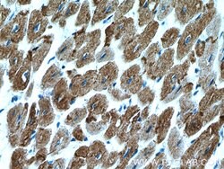 Desmin Rabbit anti-Human, Mouse, Rat, Polyclonal, Proteintech 150 &mu;L | Buy Online | Proteintech Group Inc | Fisher Scientific