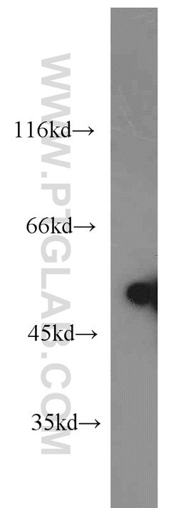 Desmin Rabbit anti-Human, Mouse, Rat, Polyclonal, Proteintech 150 &mu;L | Buy Online | Proteintech Group Inc | Fisher Scientific
