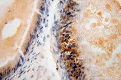NGDN Rabbit anti-Human, Mouse, Rat, Polyclonal, Proteintech 20 &mu;L; Unconjugated:Anticuerpos