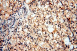 LARP4 Rabbit anti-Human, Mouse, Rat, Polyclonal, Proteintech 150 &mu;L;