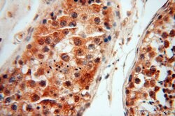 LARP4 Rabbit anti-Human, Mouse, Rat, Polyclonal, Proteintech 150 &mu;L;