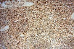 LARP4 Rabbit anti-Human, Mouse, Rat, Polyclonal, Proteintech 150 &mu;L;