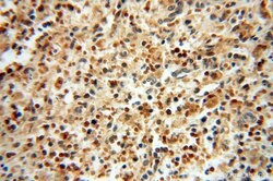 LARP4 Rabbit anti-Human, Mouse, Rat, Polyclonal, Proteintech 150 &mu;L;