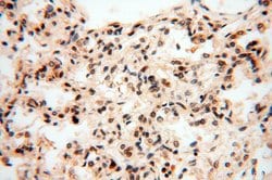 LARP4 Rabbit anti-Human, Mouse, Rat, Polyclonal, Proteintech 150 &mu;L;