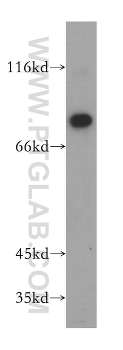 LARP4 Rabbit anti-Human, Mouse, Rat, Polyclonal, Proteintech 150 &mu;L;