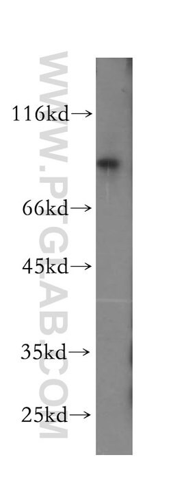 LARP4 Rabbit anti-Human, Mouse, Rat, Polyclonal, Proteintech 150 &mu;L;