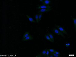 APOC4 Rabbit anti-Human, Polyclonal, Proteintech 20 &mu;L; Unconjugated:Antibodies,