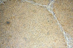 PALMD Rabbit anti-Human, Mouse, Rat, Polyclonal, Proteintech 150 &mu;L | Buy Online | Proteintech Group Inc | Fisher Scientific