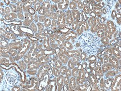 MRPS9 Rabbit anti-Human, Mouse, Rat, Polyclonal, Proteintech:Antibodies:Primary