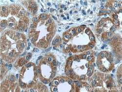 MRPS9 Rabbit anti-Human, Mouse, Rat, Polyclonal, Proteintech:Antibodies:Primary