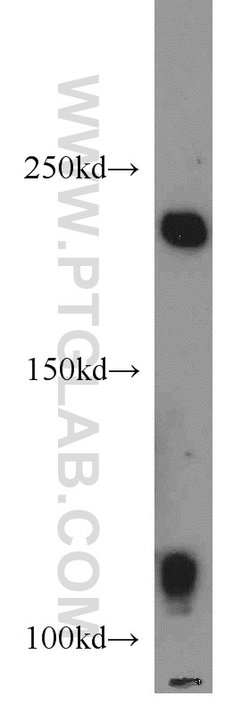 AXIN1 Rabbit anti-Human, Polyclonal, Proteintech:Antibodies:Primary Antibodies