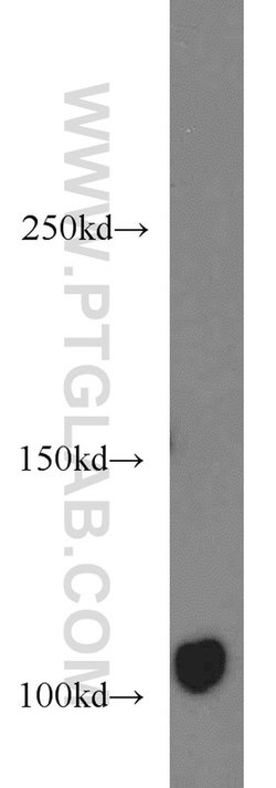 AXIN1 Rabbit anti-Human, Polyclonal, Proteintech:Antibodies:Primary Antibodies