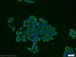 CCKBR Rabbit anti-Human, Polyclonal, Proteintech:Antibodies:Primary Antibodies