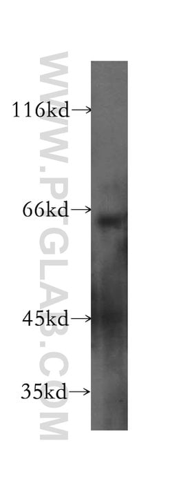 CCKBR Rabbit anti-Human, Polyclonal, Proteintech:Antibodies:Primary Antibodies