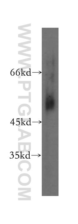 CCKBR Rabbit anti-Human, Polyclonal, Proteintech:Antibodies:Primary Antibodies