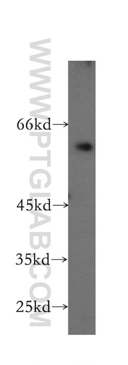CCKBR Rabbit anti-Human, Polyclonal, Proteintech:Antibodies:Primary Antibodies