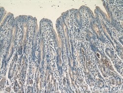 CCKAR Rabbit anti-Human, Polyclonal, Proteintech 150 &mu;L; Unconjugated:Antibodies,
