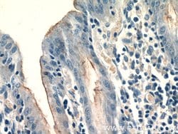 CCKAR Rabbit anti-Human, Polyclonal, Proteintech 150 &mu;L; Unconjugated:Antibodies,