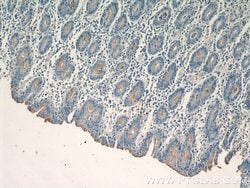 CCKAR Rabbit anti-Human, Polyclonal, Proteintech 150 &mu;L; Unconjugated:Antibodies,