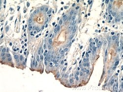 CCKAR Rabbit anti-Human, Polyclonal, Proteintech 150 &mu;L; Unconjugated:Antibodies,