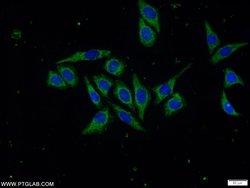 Napsin A Rabbit anti-Human, Mouse, Polyclonal, Proteintech 150 &mu;L; Unconjugated:Antibodies,
