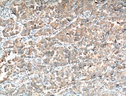 Napsin A Rabbit anti-Human, Mouse, Polyclonal, Proteintech 150 &mu;L; Unconjugated:Antibodies,
