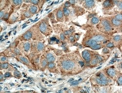 Napsin A Rabbit anti-Human, Mouse, Polyclonal, Proteintech 150 &mu;L; Unconjugated:Antibodies,