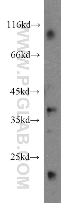 MRPL3 Rabbit anti-Human, Mouse, Rat, Polyclonal, Proteintech 150 &mu;L;
