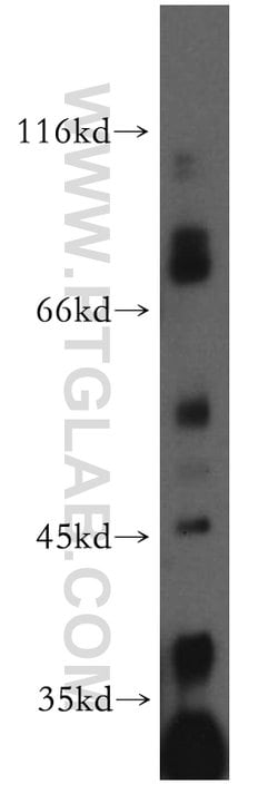 MRPL3 Rabbit anti-Human, Mouse, Rat, Polyclonal, Proteintech 150 &mu;L;