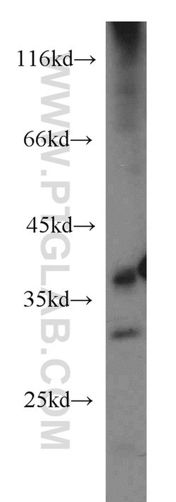 MRPL3 Rabbit anti-Human, Mouse, Rat, Polyclonal, Proteintech 150 &mu;L;
