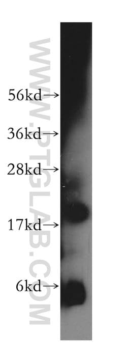 ZNHIT1 Rabbit anti-Human, Mouse, Rat, Polyclonal, Proteintech:Antibodies:Primary