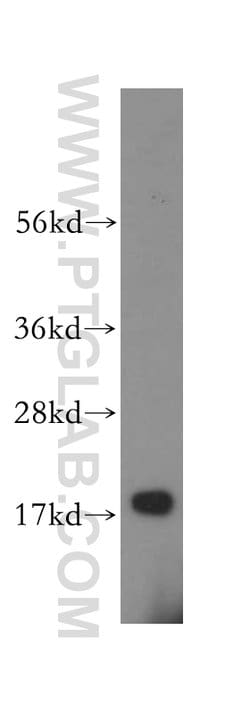 ZNHIT1 Rabbit anti-Human, Mouse, Rat, Polyclonal, Proteintech:Antibodies:Primary