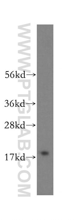 ZNHIT1 Rabbit anti-Human, Mouse, Rat, Polyclonal, Proteintech:Antibodies:Primary