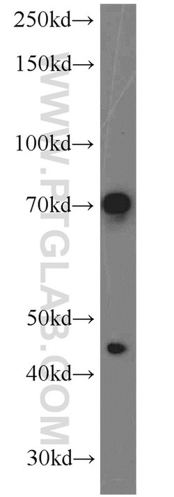 PGCP Rabbit anti-Human, Mouse, Polyclonal, Proteintech:  