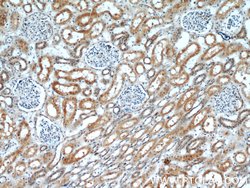 OTUD7B Rabbit anti-Human, Mouse, Rat, Polyclonal, Proteintech 150 &mu;L;
