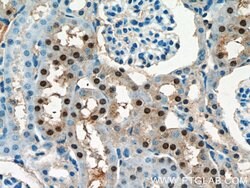 OTUD7B Rabbit anti-Human, Mouse, Rat, Polyclonal, Proteintech 150 &mu;L;