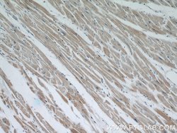 OTUD7B Rabbit anti-Human, Mouse, Rat, Polyclonal, Proteintech 150 &mu;L;